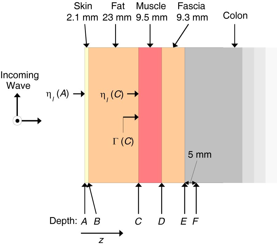 COMPUTATIONALLY EFFICIENT MODEL FOR UWB SIGNAL ATTENUATION DUE TO PROPAGATION IN TISSUE FOR BIOMEDICAL IMPLANTS
