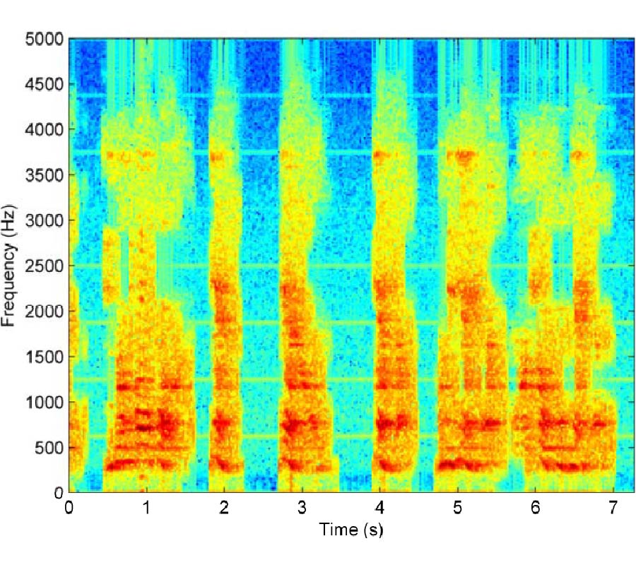 A NEW KIND OF NON-ACOUSTIC SPEECH ACQUISITION METHOD BASED ON MILLIMETER WAVERADAR