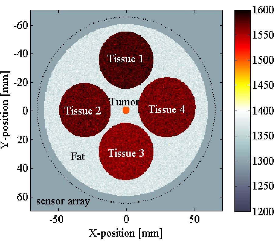RECONSTRUCTION OF MICROWAVE ABSORPTION PROPERTIES IN HETEROGENEOUS TISSUE FOR MICROWAVE-INDUCED THERMO-ACOUSTIC TOMOGRAPHY