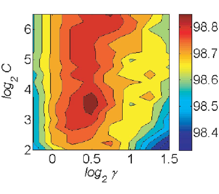 INVESTIGATION OF CLASSIFIERS FOR TUMOR DETECTION WITH AN EXPERIMENTAL TIME-DOMAIN BREAST SCREENING SYSTEM