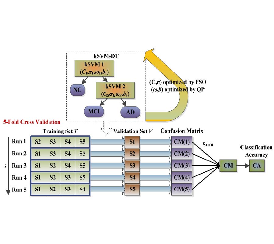 CLASSIFICATION OF ALZHEIMER DISEASE BASED ON STRUCTURAL MAGNETIC RESONANCE IMAGING BY KERNEL SUPPORT VECTOR MACHINE DECISION TREE