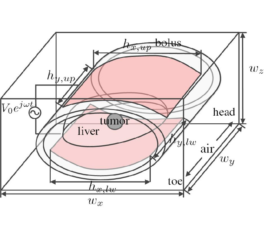 EFFICACY OF MAGNETIC AND CAPACITIVE HYPERTHERMIA ON HEPATOCELLULAR CARCINOMA