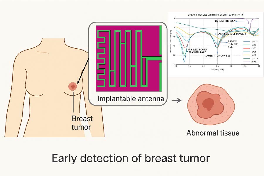 A Miniaturized CPW-fed Flexible Antenna Sensor for Implantable Breast Tumour Detection with Wireless Powering