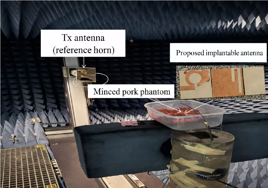 A Miniaturized Wideband PIFA Antenna for Medical Implant Systems