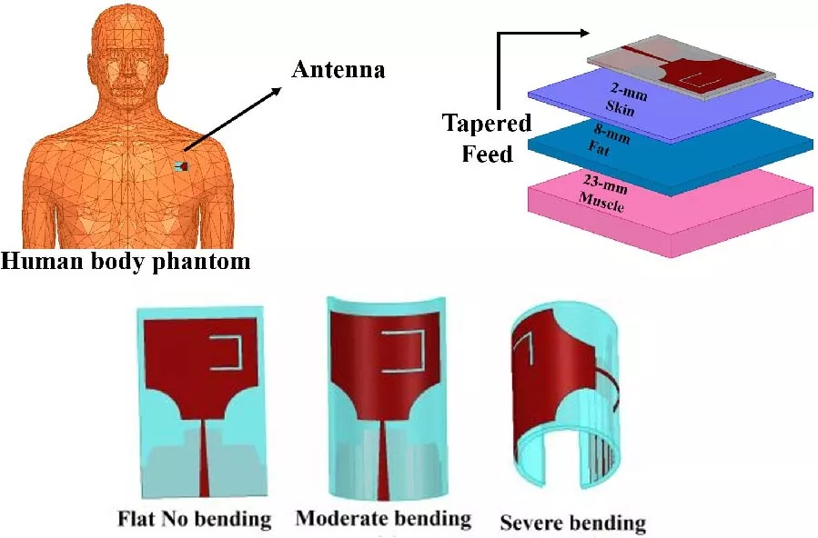 Flexible Conformal Textile-Based ETSRP Wearable Antenna for Wireless and Biomedical Applications